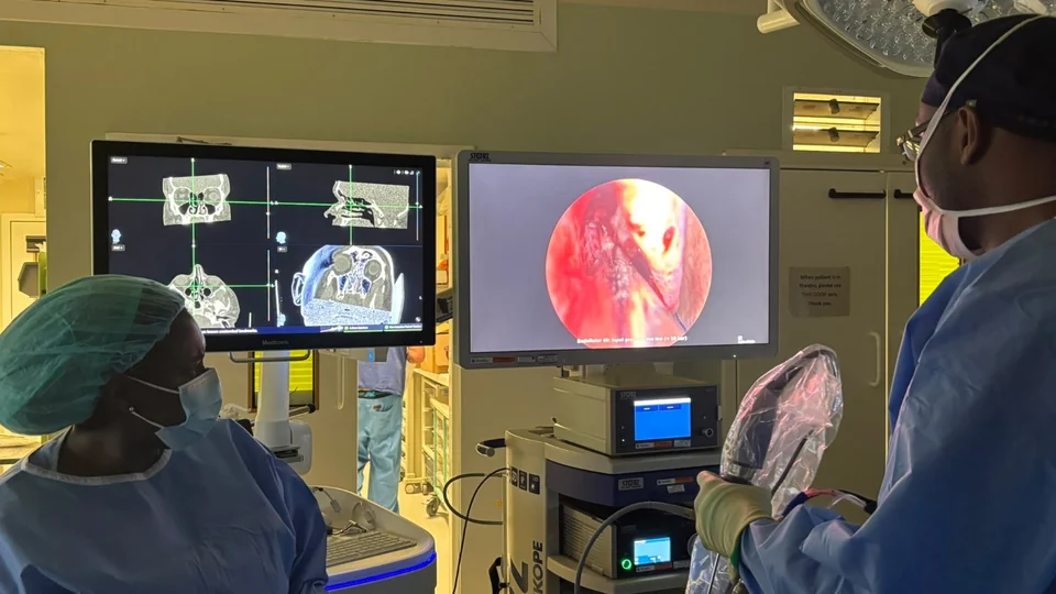 Operating theatre team using navigation and endoscopy screens during sinus surgery